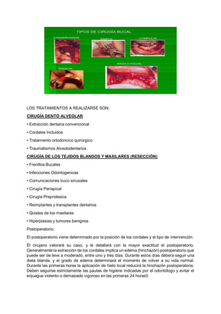 LOS TRATAMIENTOS A REALIZARSE SON:
CIRUGÍA DENTÓ ALVEOLAR
• Extracción dentaria convencional
• Cordales Incluidos
• Tratamiento ortodoncico quirúrgico
• Traumatismos Alveolodentarios
CIRUGÍA DE LOS TEJIDOS BLANDOS Y MAXILARES (RESECCIÓN)
• Frenillos Bucales
• Infecciones Odontogenicas
• Comunicaciones buco sinusales
• Cirugía Periapical
• Cirugía Preprotesica
• Reimplantes y transplantes dentarios
• Quistes de los maxilares
• Hiperplasias y tumores benignos
Postoperatorio:
El postoperatorio viene determinado por la posición de los cordales y el tipo de intervención.
El cirujano valorará su caso, y le detallará con la mayor exactitud el postoperatorio.
Generalmente la extracción de los cordales implica un edema (hinchazón) postoperatorio que
puede ser de leve a moderado, entre uno y tres días. Durante estos días deberá seguir una
dieta blanda, y el grado de edema determinará el momento de volver a su vida normal.
Durante las primeras horas la aplicación de hielo local reducirá la hinchazón postoperatoria.
Deben seguirse estrictamente las pautas de higiene indicadas por el odontólogo y evitar el
enjuague violento o demasiado vigoroso en las primeras 24 horas5
 