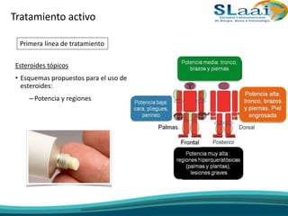 Esteroides tópicos
• Esquemas propuestos para el uso de
esteroides:
–Potencia y regiones
Tratamiento activo
Primera línea de tratamiento
 