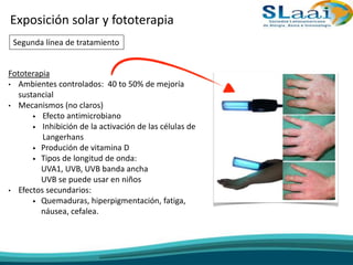 Fototerapia
• Ambientes controlados: 40 to 50% de mejoría
sustancial
• Mecanismos (no claros)
• Efecto antimicrobiano
• Inhibición de la activación de las células de
Langerhans
• Produción de vitamina D
• Tipos de longitud de onda:
UVA1, UVB, UVB banda ancha
UVB se puede usar en niños
• Efectos secundarios:
• Quemaduras, hiperpigmentación, fatiga,
náusea, cefalea.
Exposición solar y fototerapia
Segunda línea de tratamiento
 