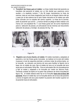 ADAPTACION DE RODETES DE CERA
Dra. NANCY CERVANTES
4. Transferir las líneas guía al rodete: La línea media facial del paciente se
transfiere del paciente al rodete con un hilo dental que usaremos como
auxiliar y la espátula numero 7 (Ay B) luego marcaremos la línea de
caninos, esta es una línea imaginaria que inicia en el ángulo interno del ojo
y pasa por el ala externa de la nariz hasta marcarla en el rodete que esta
línea coincide con la cúspide del canino superior. La línea de la sonrisa,
pedir al paciente que sonría y marcar donde se pliega el labio realizar una
marca con una espátula No. 7. Las líneas guías son de suma importancia
para la selección de piezas y la articulación de las mismas (ver documento
selección de piezas y montaje de piezas).Ver fig. 14)
5. Registro con el arco facial y el rodete: El rodete recortado y adaptado al
paciente y con las líneas guías marcadas se realizan en la cera del rodete
muescas a nivel de segunda premolar y primera molar de ambos lados, en
la horquilla se colocara una lamina de cera para facilitar la fijación de la
base con el rodete de cera, fijar el rodete de cera en la horquilla del arco
acial para el articulador Whip Mix. ,Para el articulador Bio Art procederemos
a fijar el rodete y adaptado a la horquilla por medio de silicona Putty.
Teniendo cuidado de fijarlo en la parte más posterior de dicha horquilla(ver
figura 15), el rodete deberá estar fijo en la horquilla fuera de la boca del
paciente, llevar el rodete fijo con la horquilla dentro de la boca del paciente
y tomar el registro del arco para trasferir la posición del maxilar superior en
el paciente hacia el articulador.
Página
10
 