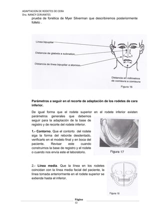 ADAPTACION DE RODETES DE CERA
Dra. NANCY CERVANTES
prueba de fonética de Myer Silverman que describiremos posteriormente
folleto .
Parámetros a seguir en el recorte de adaptación de los rodetes de cara
inferior.
De igual forma que el rodete superior en el rodete inferior existen
parámetros generales que debemos
seguir para la adaptación de la base de
registro y de recorte del rodete inferior.
1.- Contorno. Que el contorto del rodete
siga la forma del reborde desdentado,
verificarlo en el modelo final y en boca del
paciente. Revisar este cuando
construimos la base de registro y el rodete
o cuando nos envía este el laboratorio.
2.- Línea media. Que la línea en los rodetes
coincidan con la línea media facial del paciente, la
línea tomada anteriormente en el rodete superior se
extiende hasta el inferior.
Página
12
 