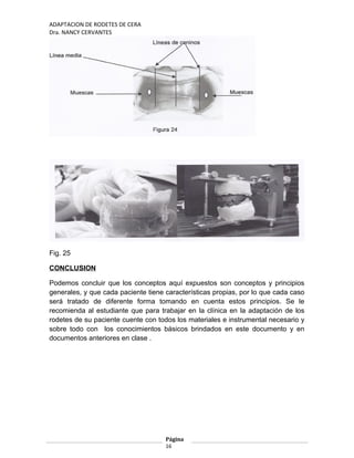 ADAPTACION DE RODETES DE CERA
Dra. NANCY CERVANTES
Fig. 25
CONCLUSION
Podemos concluir que los conceptos aquí expuestos son conceptos y principios
generales, y que cada paciente tiene características propias, por lo que cada caso
será tratado de diferente forma tomando en cuenta estos principios. Se le
recomienda al estudiante que para trabajar en la clínica en la adaptación de los
rodetes de su paciente cuente con todos los materiales e instrumental necesario y
sobre todo con los conocimientos básicos brindados en este documento y en
documentos anteriores en clase .
Página
16
 