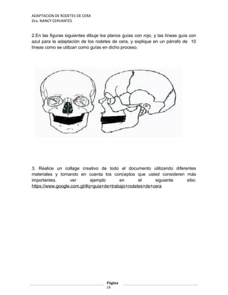 ADAPTACION DE RODETES DE CERA
Dra. NANCY CERVANTES
2.En las figuras siguientes dibuje los planos guías con rojo, y las líneas guía con
azul para la adaptación de los rodetes de cera, y explique en un párrafo de 10
líneas como se utilizan como guías en dicho proceso.
3. Realice un collage creativo de todo el documento utilizando diferentes
materiales y tomando en cuenta los conceptos que usted consideren más
importantes. ver ejemplo en el siguiente sitio:
https://www.google.com.gt/#q=guia+de+trabajo+rodetes+de+cera
Página
19
 