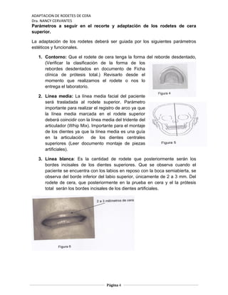 ADAPTACION DE RODETES DE CERA
Dra. NANCY CERVANTES
Parámetros a seguir en el recorte y adaptación de los rodetes de cera
superior.
La adaptación de los rodetes deberá ser guiada por los siguientes parámetros
estéticos y funcionales.
1. Contorno: Que el rodete de cera tenga la forma del reborde desdentado,
(Verificar la clasificación de la forma de los
rebordes desdentados en documento de Ficha
clínica de prótesis total.) Revisarlo desde el
momento que realizamos el rodete o nos lo
entrega el laboratorio.
2. Línea media: La línea media facial del paciente
será trasladada al rodete superior. Parámetro
importante para realizar el registro de arco ya que
la línea media marcada en el rodete superior
deberá coincidir con la línea media del tridente del
articulador (Whip Mix). Importante para el montaje
de los dientes ya que la línea media es una guía
en la articulación de los dientes centrales
superiores (Leer documento montaje de piezas
artificiales).
3. Línea blanca: Es la cantidad de rodete que posteriormente serán los
bordes incisales de los dientes superiores. Que se observa cuando el
paciente se encuentra con los labios en reposo con la boca semiabierta, se
observa del borde inferior del labio superior, únicamente de 2 a 3 mm. Del
rodete de cera, que posteriormente en la prueba en cera y el la prótesis
total serán los bordes incisales de los dientes artificiales.
Página 4
 
