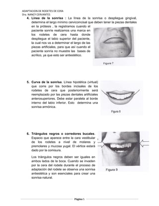 ADAPTACION DE RODETES DE CERA
Dra. NANCY CERVANTES
4. Línea de la sonrisa : La línea de la sonrisa o despliegue gingival,
determina el largo mínimo cervicoincisal que deben tener la piezas dentales
en la prótesis , la registramos cuando el
paciente sonríe realizamos una marca en
los rodetes de cera hasta donde
despliegue el labio superior del paciente,
la cual nos va a determinar el largo de las
piezas artificiales, para que así cuando el
paciente sonría no muestre las bases de
acrílico, ya que esto ser antiestético.
5. Curva de la sonrisa. Línea hipotética (virtual)
que corre por los bordes incisales de los
rodetes de cera que posteriormente será
reemplazado por las piezas dentales artificiales
anterosuperiores. Debe estar paralela al borde
interno del labio inferior. Esto determina una
sonrisa armónica.
6. Triángulos negros o corredores bucales.
Espacio que aparece entre la cara vestibular
de los rodetes a nivel de molares y
premolares y mucosa yugal. El vértice estará
dado por la comisura.
Los triángulos negros deben ser iguales en
ambos lados de la boca. Cuando se invaden
por la cera del rodete durante el proceso de
adaptación del rodete se observa una sonrisa
antiestética y son esenciales para crear una
sonrisa natural.
Página 5
 