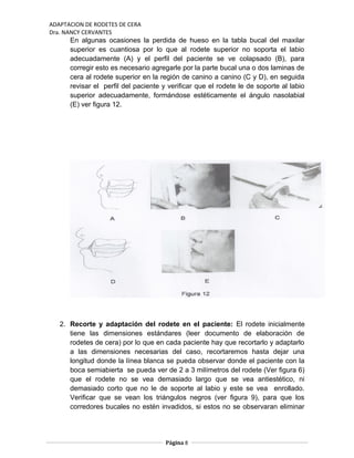 ADAPTACION DE RODETES DE CERA
Dra. NANCY CERVANTES
En algunas ocasiones la perdida de hueso en la tabla bucal del maxilar
superior es cuantiosa por lo que al rodete superior no soporta el labio
adecuadamente (A) y el perfil del paciente se ve colapsado (B), para
corregir esto es necesario agregarle por la parte bucal una o dos laminas de
cera al rodete superior en la región de canino a canino (C y D), en seguida
revisar el perfil del paciente y verificar que el rodete le de soporte al labio
superior adecuadamente, formándose estéticamente el ángulo nasolabial
(E) ver figura 12.
2. Recorte y adaptación del rodete en el paciente: El rodete inicialmente
tiene las dimensiones estándares (leer documento de elaboración de
rodetes de cera) por lo que en cada paciente hay que recortarlo y adaptarlo
a las dimensiones necesarias del caso, recortaremos hasta dejar una
longitud donde la línea blanca se pueda observar donde el paciente con la
boca semiabierta se pueda ver de 2 a 3 milímetros del rodete (Ver figura 6)
que el rodete no se vea demasiado largo que se vea antiestético, ni
demasiado corto que no le de soporte al labio y este se vea enrollado.
Verificar que se vean los triángulos negros (ver figura 9), para que los
corredores bucales no estén invadidos, si estos no se observaran eliminar
Página 8
 