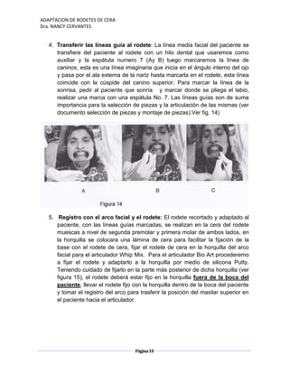 ADAPTACION DE RODETES DE CERA
Dra. NANCY CERVANTES
Página10
4. Transferir las líneas guía al rodete: La línea media facial del paciente se
transfiere del paciente al rodete con un hilo dental que usaremos como
auxiliar y la espátula numero 7 (Ay B) luego marcaremos la línea de
caninos, esta es una línea imaginaria que inicia en el ángulo interno del ojo
y pasa por el ala externa de la nariz hasta marcarla en el rodete, esta línea
coincide con la cúspide del canino superior. Para marcar la línea de la
sonrisa, pedir al paciente que sonría y marcar donde se pliega el labio,
realizar una marca con una espátula No. 7. Las líneas guías son de suma
importancia para la selección de piezas y la articulación de las mismas (ver
documento selección de piezas y montaje de piezas).Ver fig. 14)
5. Registro con el arco facial y el rodete: El rodete recortado y adaptado al
paciente, con las líneas guías marcadas, se realizan en la cera del rodete
muescas a nivel de segunda premolar y primera molar de ambos lados, en
la horquilla se colocara una lámina de cera para facilitar la fijación de la
base con el rodete de cera, fijar el rodete de cera en la horquilla del arco
facial para el articulador Whip Mix. Para el articulador Bio Art procederemo
a fijar el rodete y adaptarlo a la horquilla por medio de silicona Putty.
Teniendo cuidado de fijarlo en la parte más posterior de dicha horquilla (ver
figura 15), el rodete deberá estar fijo en la horquilla fuera de la boca del
paciente, llevar el rodete fijo con la horquilla dentro de la boca del paciente
y tomar el registro del arco para trasferir la posición del maxilar superior en
el paciente hacia el articulador.
 