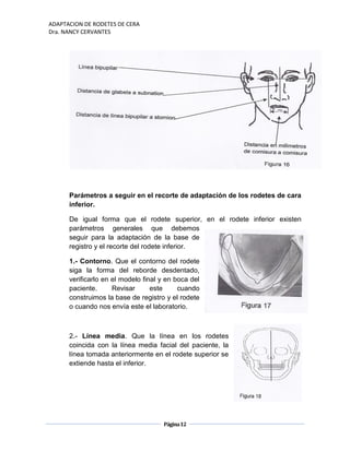 ADAPTACION DE RODETES DE CERA
Dra. NANCY CERVANTES
Página12
Parámetros a seguir en el recorte de adaptación de los rodetes de cara
inferior.
De igual forma que el rodete superior, en el rodete inferior existen
parámetros generales que debemos
seguir para la adaptación de la base de
registro y el recorte del rodete inferior.
1.- Contorno. Que el contorno del rodete
siga la forma del reborde desdentado,
verificarlo en el modelo final y en boca del
paciente. Revisar este cuando
construimos la base de registro y el rodete
o cuando nos envía este el laboratorio.
2.- Línea media. Que la línea en los rodetes
coincida con la línea media facial del paciente, la
línea tomada anteriormente en el rodete superior se
extiende hasta el inferior.
 