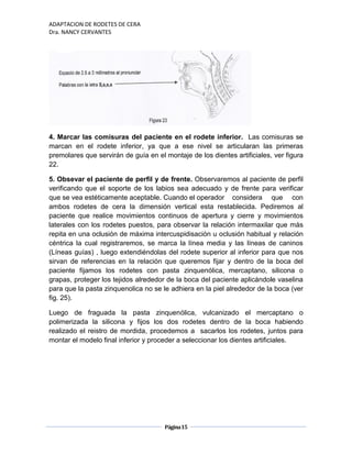 ADAPTACION DE RODETES DE CERA
Dra. NANCY CERVANTES
Página15
4. Marcar las comisuras del paciente en el rodete inferior. Las comisuras se
marcan en el rodete inferior, ya que a ese nivel se articularan las primeras
premolares que servirán de guía en el montaje de los dientes artificiales, ver figura
22.
5. Obsevar el paciente de perfil y de frente. Observaremos al paciente de perfil
verificando que el soporte de los labios sea adecuado y de frente para verificar
que se vea estéticamente aceptable. Cuando el operador considera que con
ambos rodetes de cera la dimensión vertical esta restablecida. Pediremos al
paciente que realice movimientos continuos de apertura y cierre y movimientos
laterales con los rodetes puestos, para observar la relación intermaxilar que más
repita en una oclusión de máxima intercuspidisación u oclusión habitual y relación
céntrica la cual registraremos, se marca la línea media y las líneas de caninos
(Líneas guías) , luego extendiéndolas del rodete superior al inferior para que nos
sirvan de referencias en la relación que queremos fijar y dentro de la boca del
paciente fijamos los rodetes con pasta zinquenólica, mercaptano, silicona o
grapas, proteger los tejidos alrededor de la boca del paciente aplicándole vaselina
para que la pasta zinquenolica no se le adhiera en la piel alrededor de la boca (ver
fig. 25).
Luego de fraguada la pasta zinquenólica, vulcanizado el mercaptano o
polimerizada la silicona y fijos los dos rodetes dentro de la boca habiendo
realizado el reistro de mordida, procedemos a sacarlos los rodetes, juntos para
montar el modelo final inferior y proceder a seleccionar los dientes artificiales.
 