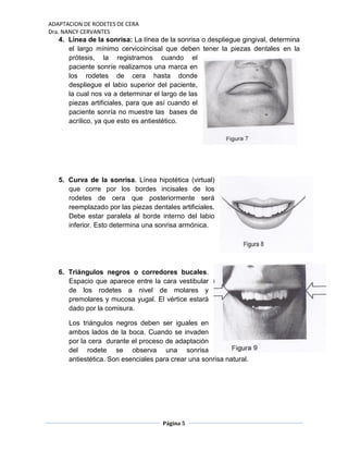 ADAPTACION DE RODETES DE CERA
Dra. NANCY CERVANTES
Página 5
4. Línea de la sonrisa: La línea de la sonrisa o despliegue gingival, determina
el largo mínimo cervicoincisal que deben tener la piezas dentales en la
prótesis, la registramos cuando el
paciente sonríe realizamos una marca en
los rodetes de cera hasta donde
despliegue el labio superior del paciente,
la cual nos va a determinar el largo de las
piezas artificiales, para que así cuando el
paciente sonría no muestre las bases de
acrílico, ya que esto es antiestético.
5. Curva de la sonrisa. Línea hipotética (virtual)
que corre por los bordes incisales de los
rodetes de cera que posteriormente será
reemplazado por las piezas dentales artificiales.
Debe estar paralela al borde interno del labio
inferior. Esto determina una sonrisa armónica.
6. Triángulos negros o corredores bucales.
Espacio que aparece entre la cara vestibular
de los rodetes a nivel de molares y
premolares y mucosa yugal. El vértice estará
dado por la comisura.
Los triángulos negros deben ser iguales en
ambos lados de la boca. Cuando se invaden
por la cera durante el proceso de adaptación
del rodete se observa una sonrisa
antiestética. Son esenciales para crear una sonrisa natural.
 