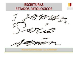 ESCRITURAS
ESTADOS PATOLOGICOS
TRAZADO GRAFOPATOLOGICO – MAL DE PARKINSON
 