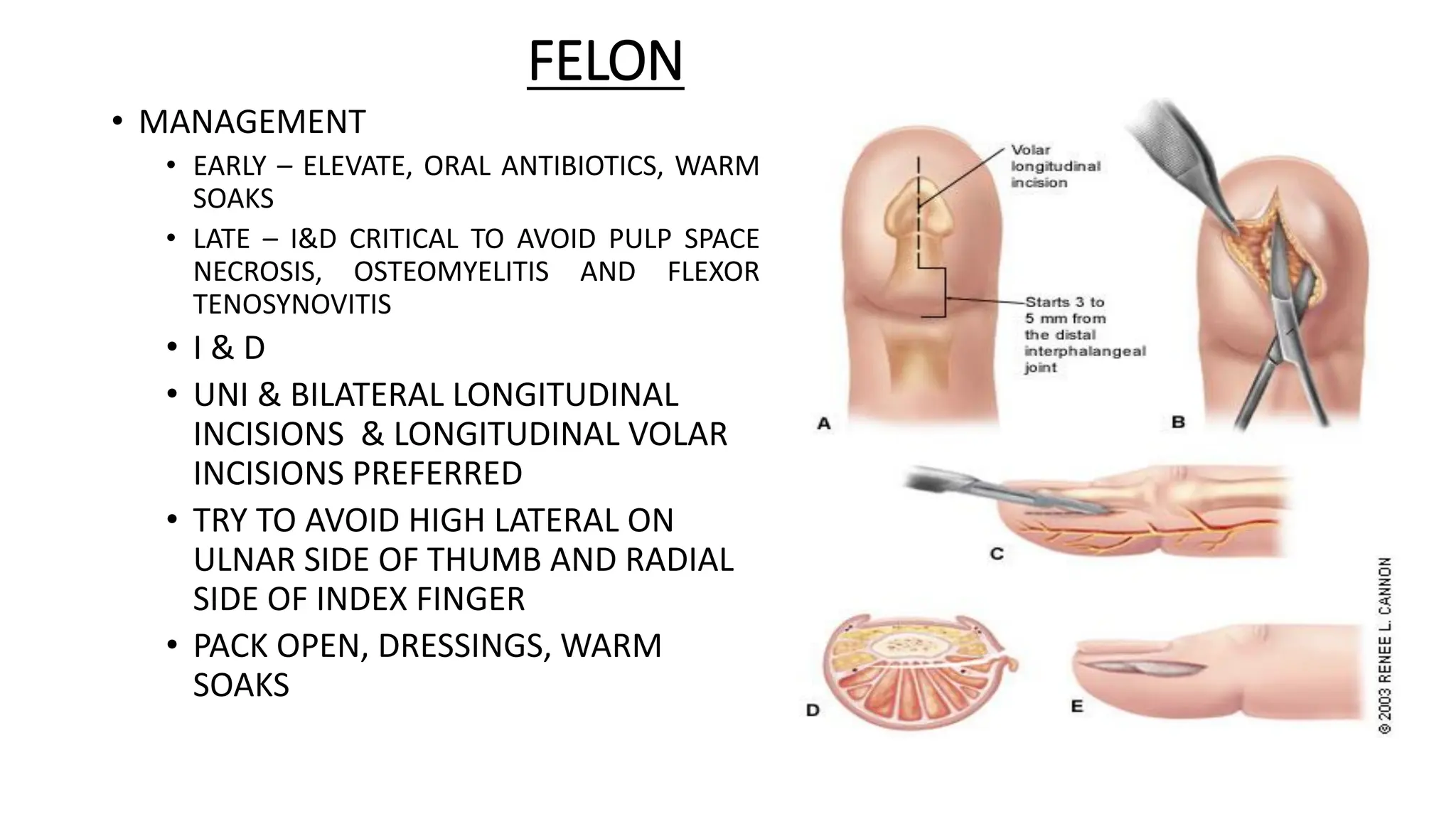 Incision Finger Pulp documents_null-ANATOMY+OF+HAND+SPACE,+INFECTIONS+OF+HAND (2).pdf