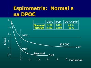 Espirometria:  Normal e na DPOC 