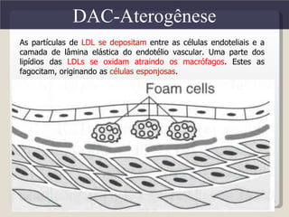 DAC-Aterogênese
As partículas de LDL se depositam entre as células endoteliais e a
camada de lâmina elástica do endotélio vascular. Uma parte dos
lipídios das LDLs se oxidam atraindo os macrófagos. Estes as
fagocitam, originando as células esponjosas.




                                                                     19
 