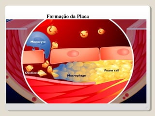 Formação da Placa




                    21
 