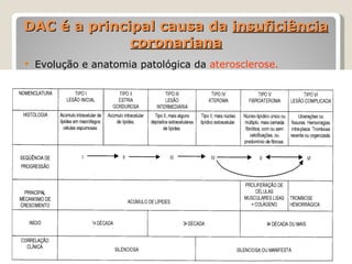 DAC é a principal causa da insuficiência
              coronariana
   Evolução e anatomia patológica da aterosclerose.
 