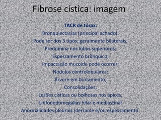 Fibrose cística: imagem
                  TACR de tórax:
         Bronquiectasias (principal achado):
    Pode ser dos 3 tipos; geralmente bilaterais;
          Predomina nos lobos superiores;
             Espessamento brônquico;
         Impactação mucoide pode ocorrer;
             Nódulos centrolobulares;
              Árvore em brotamento;
                   Consolidações;
      Lesões císticas ou bolhosas nos ápices;
       Linfonodomegalias hilar e mediastinal
Anormalidades pleurais (derrame e/ou espessamento)
 