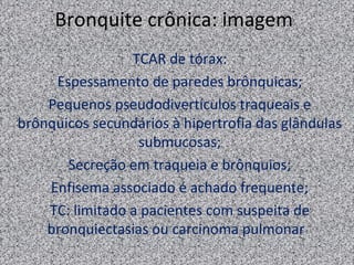Bronquite crônica: imagem
                 TCAR de tórax:
     Espessamento de paredes brônquicas;
    Pequenos pseudodivertículos traqueais e
brônquicos secundários à hipertrofia das glândulas
                  submucosas;
       Secreção em traqueia e brônquios;
    Enfisema associado é achado frequente;
    TC: limitado a pacientes com suspeita de
    bronquiectasias ou carcinoma pulmonar.
 