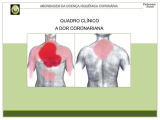 A DOR CORONARIANA
QUADRO CLÍNICO
 