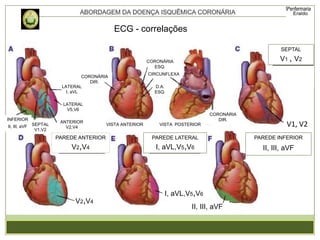 ECG - correlações
SEPTAL
V1 , V2
V1, V2
PAREDE INFERIOR
II, III, aVF
II, III, aVF
I, aVL,V5,V6
PAREDE LATERAL
I, aVL,V5,V6
V2,V4
LATERAL
V5,V6
CORONÁRIA
DIR.
ANTERIOR
V2,V4
SEPTAL
V1,V2
INFERIOR
II, III, aVF
PAREDE ANTERIOR
V2,V4
LATERAL
I, aVL
CORONÁRIA
ESQ.
CORONÁRIA
DIR.
CIRCUNFLEXA
D.A.
ESQ.
VISTA ANTERIOR VISTA POSTERIOR
 