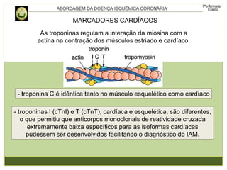 MARCADORES CARDÍACOS
As troponinas regulam a interação da miosina com a
actina na contração dos músculos estriado e cardíaco.
- troponina C é idêntica tanto no músculo esquelético como cardíaco
- troponinas I (cTnI) e T (cTnT), cardíaca e esquelética, são diferentes,
o que permitiu que anticorpos monoclonais de reatividade cruzada
extremamente baixa específicos para as isoformas cardíacas
pudessem ser desenvolvidos facilitando o diagnóstico do IAM.
 