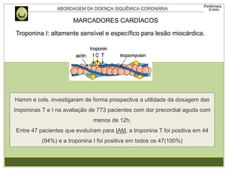 Troponina I: altamente sensível e específico para lesão miocárdica.
MARCADORES CARDÍACOS
Hamm e cols. investigaram de forma prospectiva a utilidade da dosagem das
troponinas T e I na avaliação de 773 pacientes com dor precordial aguda com
menos de 12h.
Entre 47 pacientes que evoluíram para IAM, a troponina T foi positiva em 44
(94%) e a troponina I foi positiva em todos os 47(100%)
 