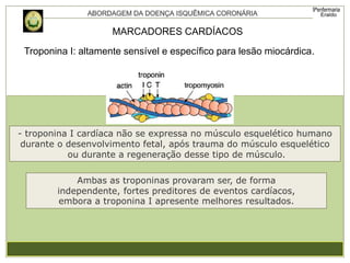 Troponina I: altamente sensível e específico para lesão miocárdica.
MARCADORES CARDÍACOS
- troponina I cardíaca não se expressa no músculo esquelético humano
durante o desenvolvimento fetal, após trauma do músculo esquelético
ou durante a regeneração desse tipo de músculo.
Ambas as troponinas provaram ser, de forma
independente, fortes preditores de eventos cardíacos,
embora a troponina I apresente melhores resultados.
 