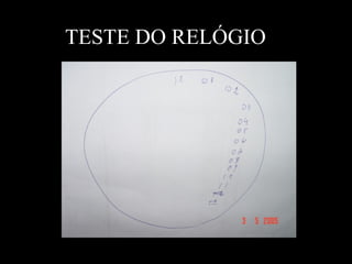 TESTE DO RELÓGIO 