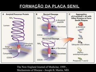 FORMAÇÃO DA PLACA SENIL The New England Journal of Medicine, 1999 , Mechanisms of Disease - Joseph B. Martin, MD.  