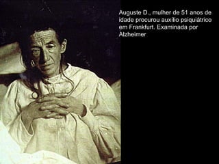 Auguste D., mulher de 51 anos de idade procurou auxílio psiquiátrico em Frankfurt. Examinada por Alzheimer  