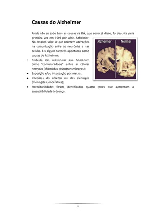Causas do Alzheimer
Ainda não se sabe bem as causas da DA, que como já disse, foi descrita pela
primeira vez em 1909 por Alois Alzheimer.
No entanto sabe-se que ocorrem alterações
na comunicação entre os neurónios e nas
células. Eis alguns factores apontados como
causas do Alzheimer:
Redução das substâncias que funcionam
como “comunicadoras” entre as células
nervosas (chamadas neurotransmissores);
Exposição e/ou intoxicação por metais;
Infecções do cérebro ou das meninges
(meningites, encefalites);
Hereditariedade: foram identificados quatro genes que aumentam a
susceptibilidade à doença.




                                 6
 