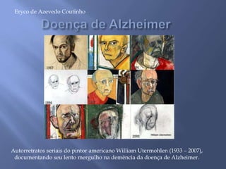 Autorretratos seriais do pintor americano William Utermohlen (1933 – 2007),
documentando seu lento mergulho na demência da doença de Alzheimer.
Eryco de Azevedo Coutinho
 