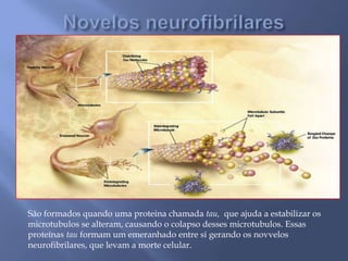 São formados quando uma proteina chamada tau, que ajuda a estabilizar os
microtubulos se alteram, causando o colapso desses microtubulos. Essas
proteínas tau formam um emeranhado entre si gerando os novvelos
neurofibrilares, que levam a morte celular.
 