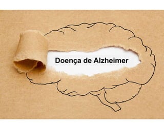 Doença de Alzheimer
 