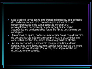 Esse aspecto talvez tenha um grande significado, pois estudos de medicina nuclear têm revelado áreas miocárdicas de hipocontratilidade e de baixa perfusão coronariana, provavelmente decorrentes de alterações da inervação autonômica ou de destruições focais de fibras dos sistema de condução. Em ambos os casos, poder-se-iam formar áreas com distúrbios de despolarização que seriam comprimidas e distendidas em cada sístole ventricular, assim sofrendo gradativa atrofia. Ao ser seccionado, o miocárdio mostra uma fina e difusa fibrose, mas bem apreciada em secções longitudinais ao longo do septo interventricular. Por vezes, esse septo mostra de espessura muitoreduzida. 