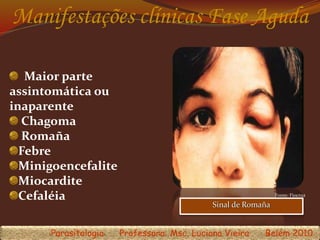 Manifestações clínicas Fase Aguda
Sinal de Romaña
Fonte: Fiocruz
Maior parte
assintomática ou
inaparente
Chagoma
Romaña
Febre
Minigoencefalite
Miocardite
Cefaléia
Parasitologia Professora: Msc. Luciana Vieira Belém 2010
 