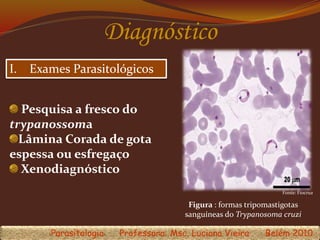 Diagnóstico
Fonte: Fiocruz
I. Exames Parasitológicos
Figura : formas tripomastigotas
sanguíneas do Trypanosoma cruzi
Parasitologia Professora: Msc. Luciana Vieira Belém 2010
Pesquisa a fresco do
trypanossoma
Lâmina Corada de gota
espessa ou esfregaço
Xenodiagnóstico
 