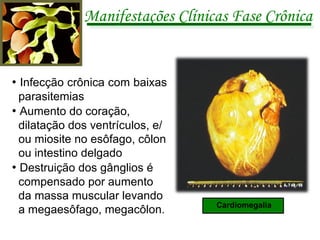 Manifestações Clínicas Fase Crônica •  Infecção crônica com baixas parasitemias  •  Aumento do coração, dilatação dos ventrículos, e/ou miosite no esôfago, côlon ou intestino delgado •  Destruição dos gânglios é compensado por aumento da massa muscular levando a megaesôfago, megacôlon. Cardiomegalia 