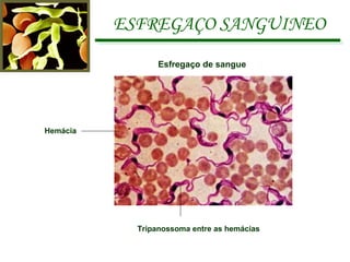 ESFREGAÇO SANGUINEO Esfregaço de sangue Hemácia Tripanossoma entre as hemácias 