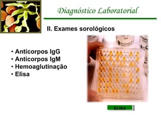 Diagnóstico Laboratorial II. Exames sorológicos  •  Anticorpos IgG •  Anticorpos IgM •  Hemoaglutinação •  Elisa ELISA 