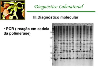 Diagnóstico Laboratorial III.Diagnóstico molecular •  PCR ( reação em cadeia da polimerase) 