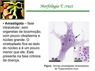 Morfologia T. cruzi •  Amastigota  – fase intracelular, sem organelas de locomoção, com pouco citoplasma e núcleo grande. O cinetoplasto fica ao lado do núcleo e é um pouco menor que ele. Está presente na fase crônica da doença. Figura  : formas amastigotas intracelulares do  Trypanosoma cruzi 