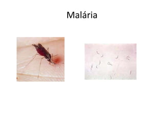 Malária
 