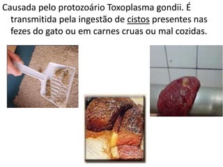 Causada pelo protozoário Toxoplasma gondii. É
  transmitida pela ingestão de cistos presentes nas
  fezes do gato ou em carnes cruas ou mal cozidas.
 