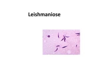 Leishmaniose
 