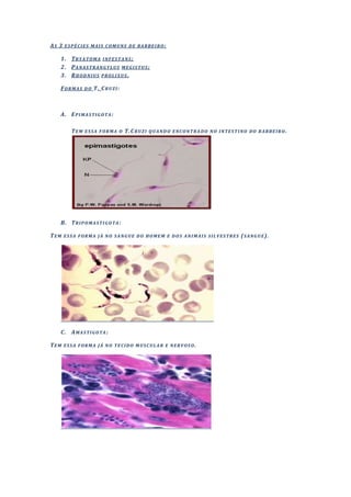 AS 3 ESPÉCIES MAIS COMUNS DE BARBEIRO:

     1. TRYATOMA INFESTANS;
     2. PANASTRANGYLUS MEGISTUS;
     3. RHODNIUS PROLIXUS.

     F O R M A S D O T. C R U Z I :



     A. E P I M A S T I G O T A :

           T E M E S S A F O R M A O T.C R U Z I Q U A N D O E N C O N T R A D O N O I N T E S T I N O D O B A R B E I R O .




     B. T R I P O M A S T I G O T A :

T E M E S S A F O R M A J Á N O S A N G U E D O H O M E M E D O S A N I M A I S S I L V E S T R E S ( S A N G U E ).




     C. A M A S T I G O T A :

TEM ESSA FORMA JÁ NO TECIDO MUSCULAR E NERVOSO.
 