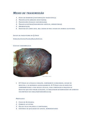M EIOS DE TRANSMISSÃO
     1.    FEZES DO BARBEIRO (CONTAMINAÇÃO TRADICI ONAL);
     2.    TRANSPLANTES (ÓRGÃOS INFECTADOS);
     3.    TRANSFUSÕES (SANGUE CONTAMINADO);
     4.    TRANSPLACENTÁRIA(TRANSMISSÃO VERTICAL , HEREDITÁRIA);
     5.    AMAMENTAÇÃO;
     6.    INGESTÃO DE CARNE CRU A, MAL COZIDA OU MAL AS SADA DE ANIMAIS SILVESTRES.



L O C A I S D E P A R A S I T I S M O D O T. C R U Z I

CORAÇÃO,COLON,FIGADO,BAÇO,ESÔFAGO.



CASO DE CARDIOMEGALIA.




           O T. C R U Z I A O A T I N G I R O C O R A Ç Ã O , C O M P R O M E T E O M I O C Á R D I O , I N V A D E O S
           M I O C I T O S , E S E R E P R O D U Z A S S E X U A D A M E N T E . O T.C R U Z I L E S A O S M I Ó C I T O S
           COMPROMETENDO A VIDA DESSAS CÉLULAS, PARA COMPENSAR O PRE JUÍZO OS
           MIOCITOS QUE NÃO FOR AM ATINGIDOS, SE PROLIFERAM DETERMINANDO UM AUMENTO
           V O L U M É T R I C O D O C O R A Ç Ã O (C A R D I O M E G A L I A ).




     PROFILAXIA:

     1.    CASAS DE ALVENARIA;
     2.    COMBATE AO VETOR ;
     3.    USO DE TELAS EM JANEL A E CORTINADOS ;
     4.    CONTROLE DE QUALIDADE DE SANGUE, HEMODERIVADOS.
 