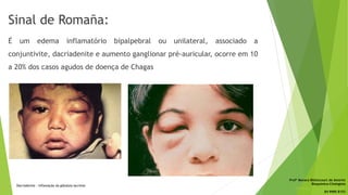 Sinal de Romaña:
É um edema inflamatório bipalpebral ou unilateral, associado a
conjuntivite, dacriadenite e aumento ganglionar pré-auricular, ocorre em 10
a 20% dos casos agudos de doença de Chagas
Dacriadenite : Inflamação da glândula lacrimal
Profª Monara Bittencourt de Amorim
Bioquímica-Citologista
bittencourt.monara7@gmail.com
84 9985 8153
 