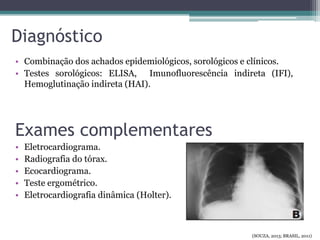 Diagnóstico
• Combinação dos achados epidemiológicos, sorológicos e clínicos.
• Testes sorológicos: ELISA, Imunofluorescência indireta (IFI),
Hemoglutinação indireta (HAI).
Exames complementares
• Eletrocardiograma.
• Radiografia do tórax.
• Ecocardiograma.
• Teste ergométrico.
• Eletrocardiografia dinâmica (Holter).
(SOUZA, 2013; BRASIL, 2011)
 
