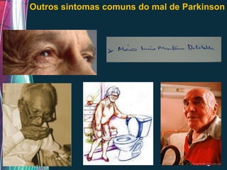 Outros sintomas comuns do mal de Parkinson




            Free Powerpoint Templates
                                        Page 14
 